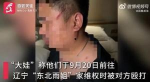 东北口音吃瓜博主视频,带你领略方言魅力与娱乐圈风云